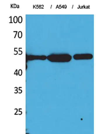 Tubulin α (Acetyl Lys352) rabbit pAb - image 1