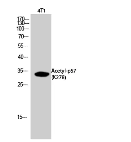 p57 (Acetyl Lys278) rabbit pAb