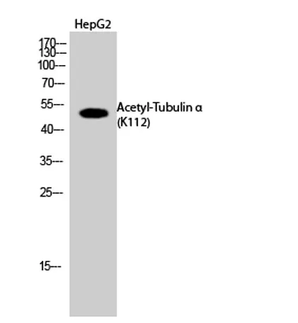 Tubulin α (Acetyl Lys112) rabbit pAb - image 1