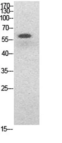 NFκB-p65 (Acetyl Lys314/Lys315) rabbit pAb - image 1