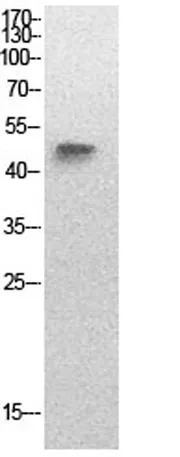 p53 (Acetyl Lys320) rabbit pAb