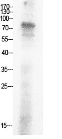 Ub (Acetyl Lys29) rabbit pAb