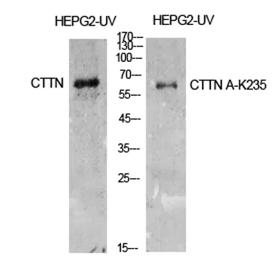 Cortactin (Acetyl Lys235) rabbit pAb - image 1