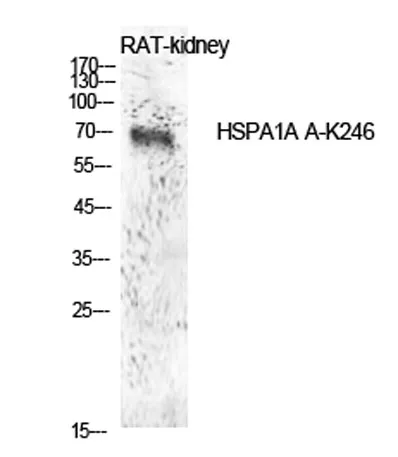 HSP70 (Acetyl Lys246) rabbit pAb - image 1