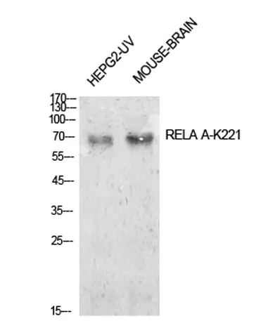 NFκB-p65 (Acetyl Lys221) rabbit pAb - image 1