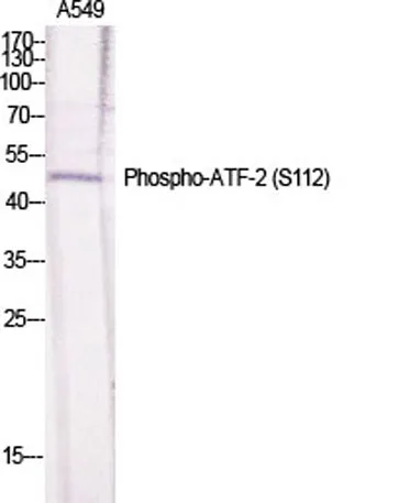 ATF-2 (phospho Ser112) rabbit pAb - image 1