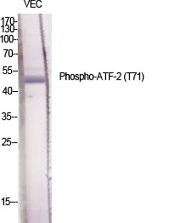 ATF-2 (phospho Thr71) rabbit pAb - image 1
