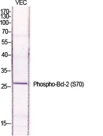 Bcl-2 (phospho Ser70) rabbit pAb - image 1