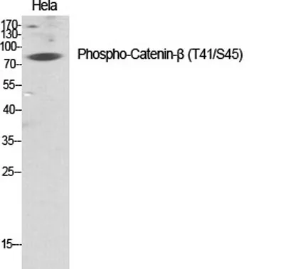 Catenin-β (phospho Thr41/S45) rabbit pAb - image 1