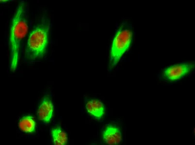 Chk2 (phospho Thr68) rabbit pAb - image 1