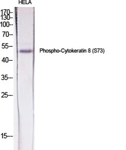 Cytokeratin 8 (phospho Ser73) rabbit pAb - image 1