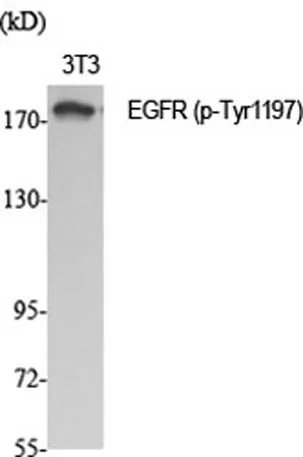 EGFR (phospho Tyr1197) rabbit pAb - image 1