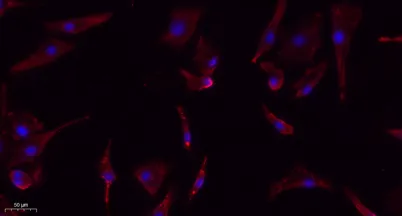 eIF2α (phospho Ser51) rabbit pAb - image 1