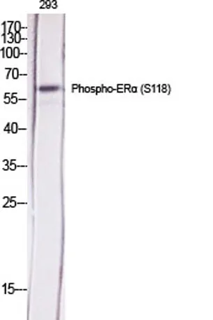 ERα (phospho Ser118) rabbit pAb - image 1