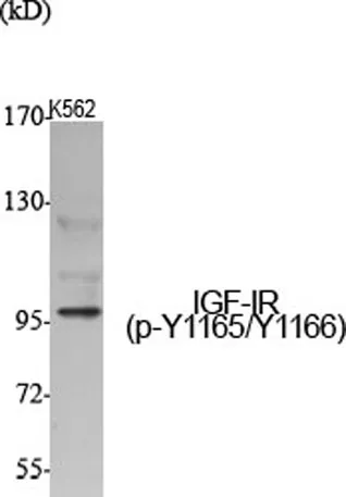 IGF-IR (phospho Tyr1165/Y1166) rabbit pAb - image 1