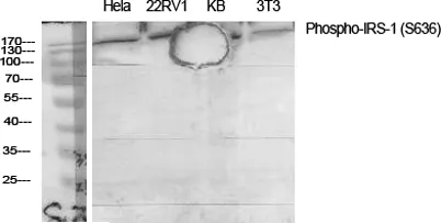 IRS-1 (phospho Ser636) rabbit pAb - image 1