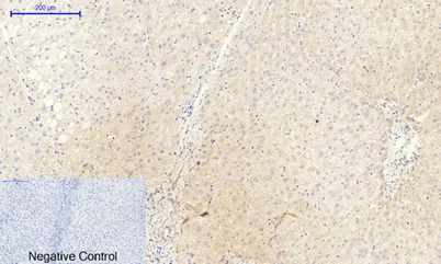 JAK2 (phospho Tyr1007) rabbit pAb - image 1