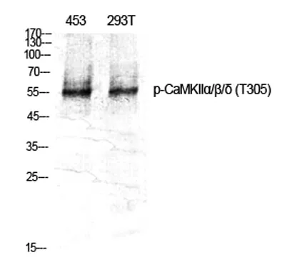 CaMKIIα/β/δ (phospho Thr305) rabbit pAb - image 1