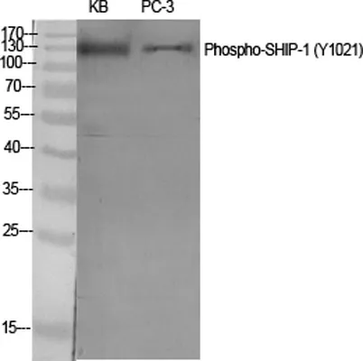 SHIP-1 (phospho Tyr1021) rabbit pAb - image 1