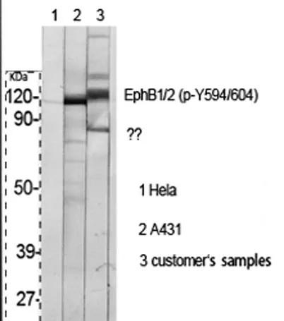 EphB1/2 (phospho Tyr594/604) rabbit pAb - image 1