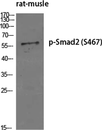 Smad2 (phospho Ser467) rabbit pAb - image 1