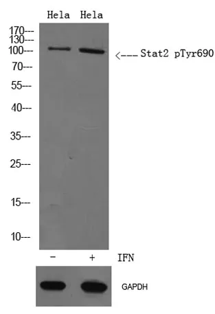 Stat2 (phospho Tyr690) rabbit pAb - image 1