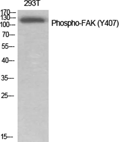 FAK (phospho Tyr407) rabbit pAb - image 1