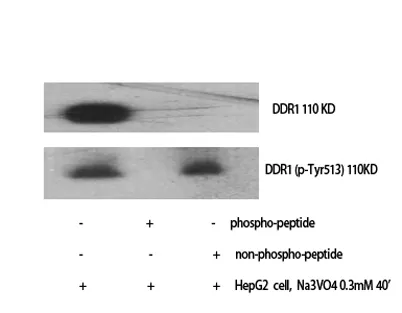DDR1 (phospho Tyr513) rabbit pAb - image 1