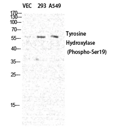 TH (phospho Ser19) rabbit pAb - image 1