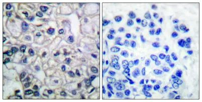 IGF-IR (phospho Tyr1161) rabbit pAb - image 1