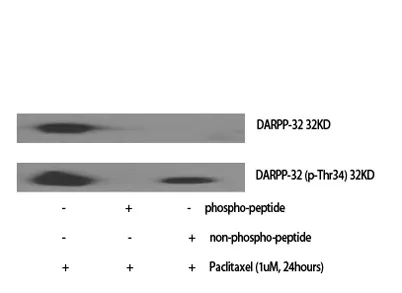 DARPP-32 (phospho Thr34) rabbit pAb - image 1