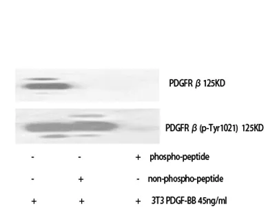 PDGFR-β (phospho Tyr1021) rabbit pAb - image 1