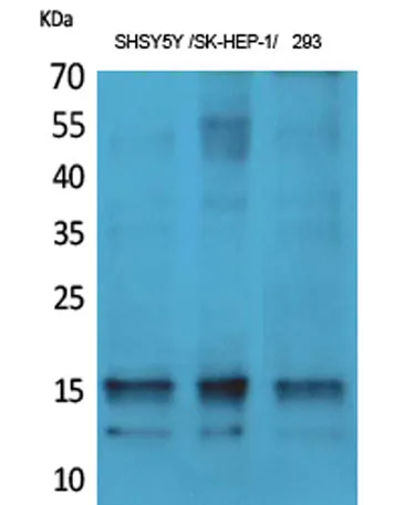 Synuclein-α (phospho Tyr125) rabbit pAb - image 1