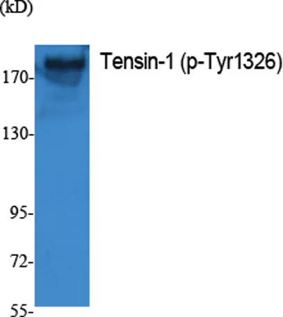 Tensin-1 (phospho Tyr1326) rabbit pAb - image 1