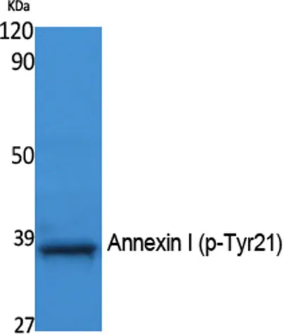 Annexin I (phospho Tyr21) rabbit pAb - image 1