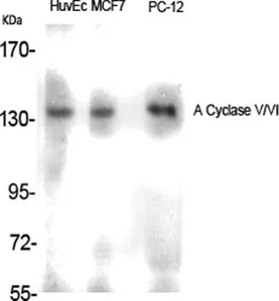 A Cyclase V/VI rabbit pAb - image 1