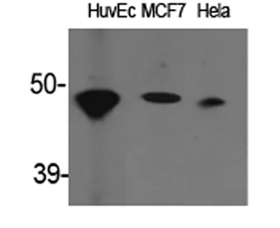 ACAT-1 rabbit pAb - image 1