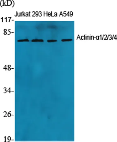 Actinin-α1/2/3/4 rabbit pAb - image 1