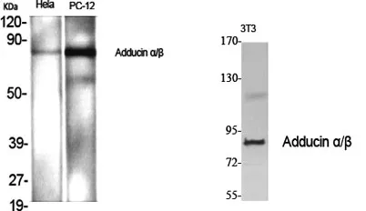 Adducin α/β rabbit pAb - image 1