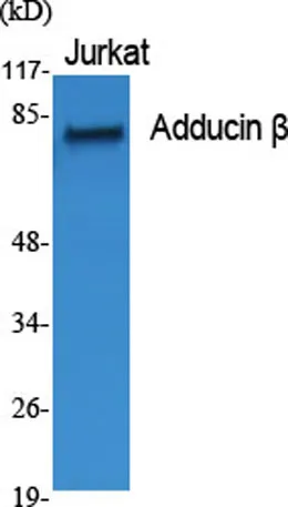 Adducin β rabbit pAb - image 1