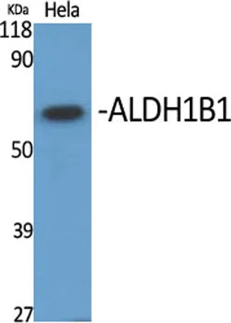 ALDH1B1 rabbit pAb - image 1