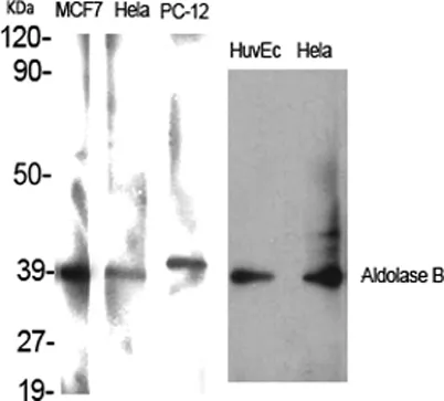 Aldolase B rabbit pAb - image 1