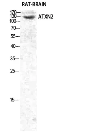 Ataxin-2 rabbit pAb - image 1