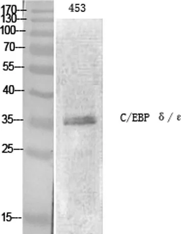 C/EBP ε rabbit pAb - image 1