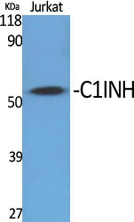 C1INH rabbit pAb - image 1