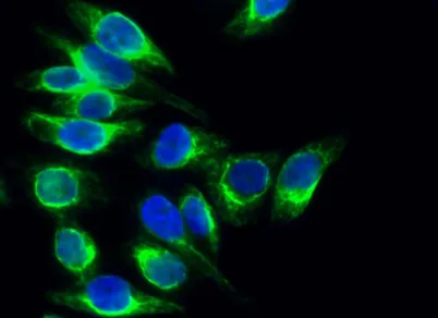Calregulin rabbit pAb - image 1