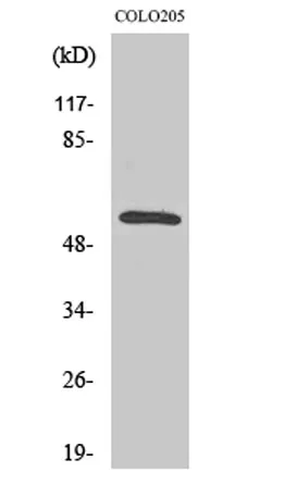 CaMKIIβ/γ rabbit pAb - image 1
