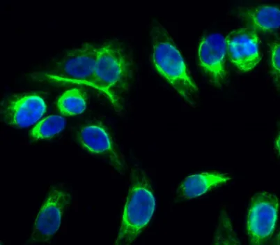 Catenin-α E/N rabbit pAb - image 1