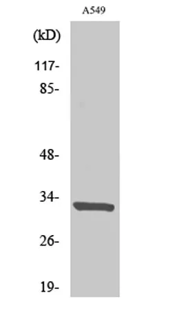 CD20 rabbit pAb - image 1