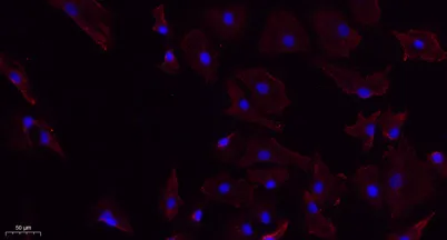 ChemR23 rabbit pAb
